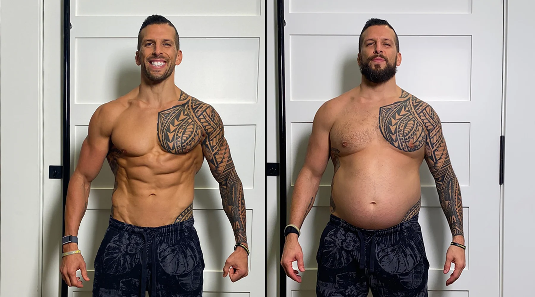 What are the best injectable drugs for weight loss?